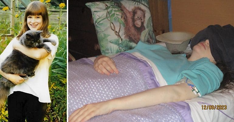 Karen Gordon before and after getting severe ME NHS