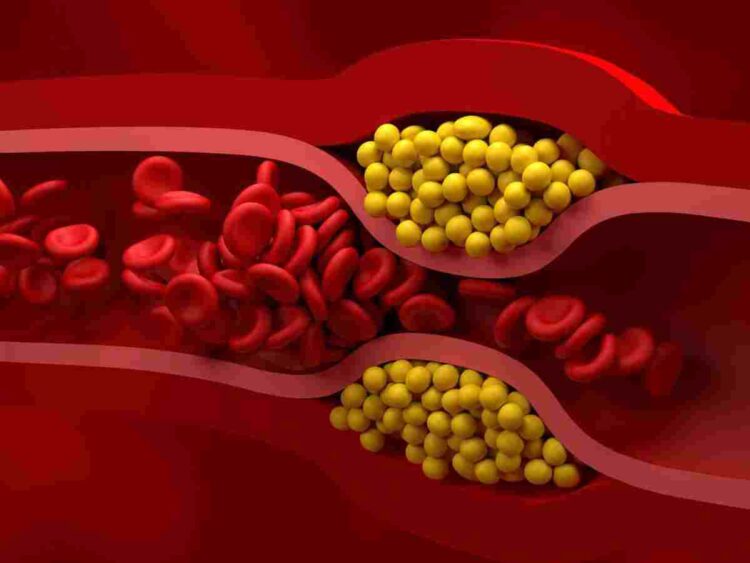 cholesterol